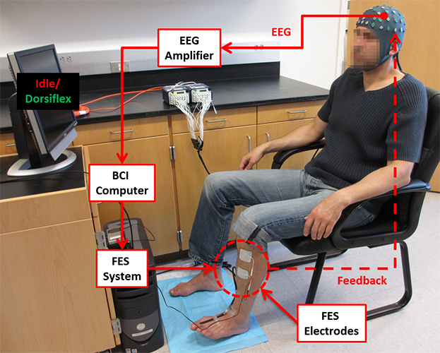 The device includes an electrode-laden elastic cap, an amplifier that magnifies brain signals and sends them from patient to computer, and a functional electrical stimulator, which attaches to the patient’s tibialis anterior (shin) muscles.