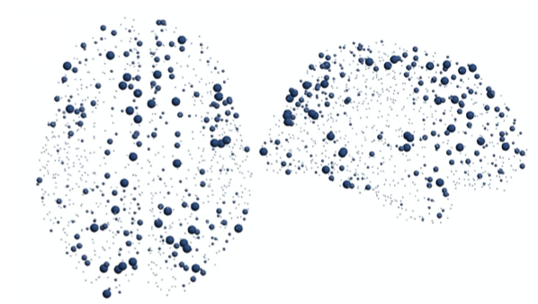 Graphing MRI data using network curvature enabled scientists at UCI, the University of Minnesota and other institutions to identify areas of robustness and weakness in neural networks, with diagnosis and treatment implications for aging and autism.