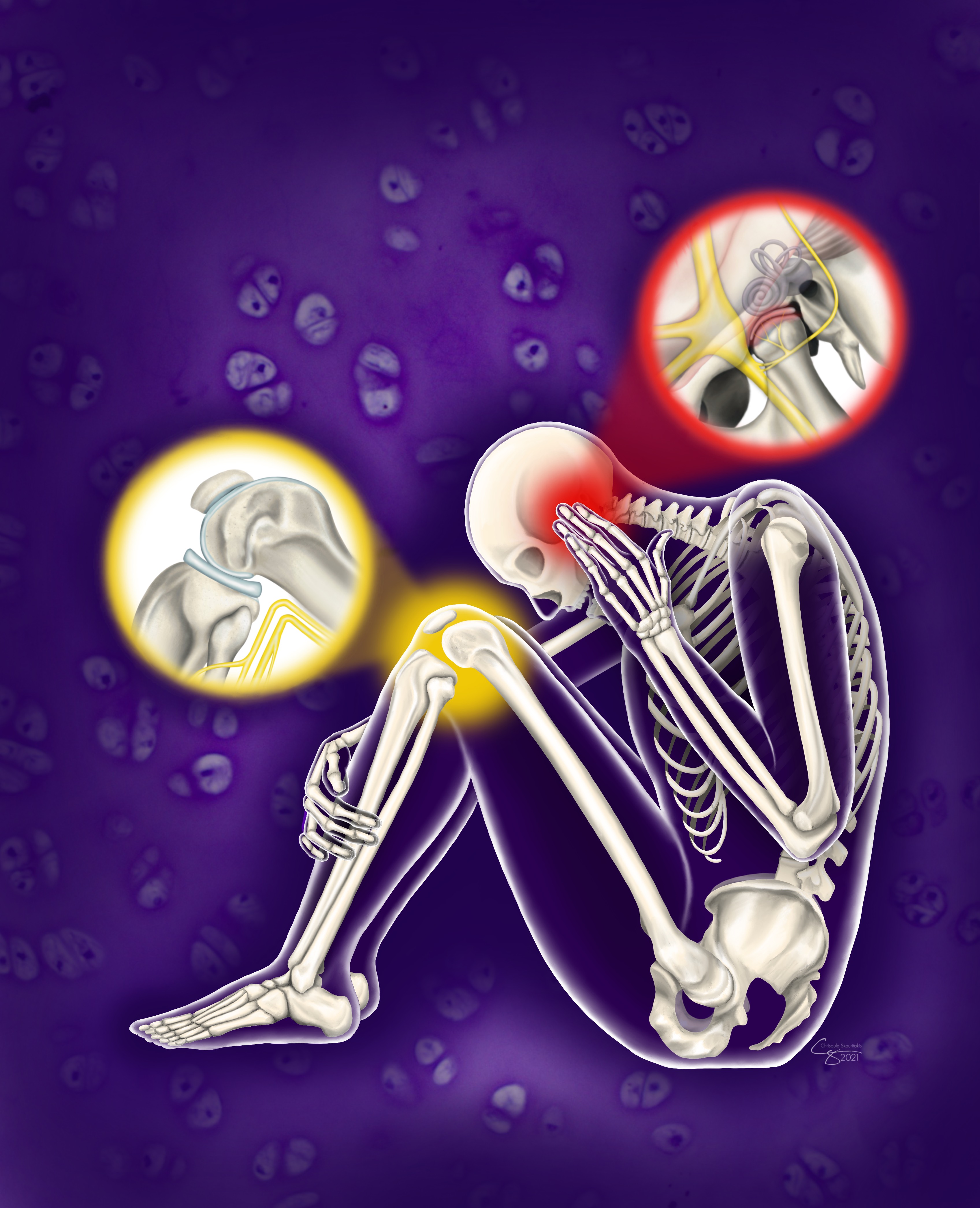 In a study in the journal Cell Reports Medicine, UCI biomedical engineering researchers discussed the similarities and differences between treatments for disorders of the knee and TMJ, suggesting ways to improve outcomes for people suffering from jaw pain. Chrisoula Skouritakis / UC Davis