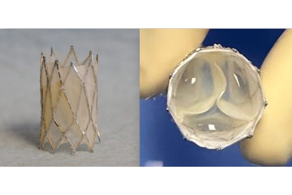 The Iris Valve, a transcatheter, growth-accommodating pulmonary valve designed for very young children, was developed at UC Irvine and is currently progressing toward FDA clinical approval. Arash Kheradvar The Iris Valve, a transcatheter, growth-accommodating pulmonary valve designed for very young children, was developed at UC Irvine and is currently progressing toward FDA clinical approval. Arash Kheradvar