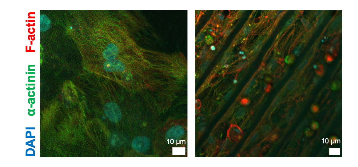 Human stem cell-derived heart muscle cells interfaced with the engineered biomolecule (peptide) pairs reported in the paper, fabricated as a film substrate (left) or as line patterns on a hydrogel scaffold (right). Human stem cell-derived heart muscle cells interfaced with the engineered biomolecule (peptide) pairs reported in the paper, fabricated as a film substrate (left) or as line patterns on a hydrogel scaffold (right).
