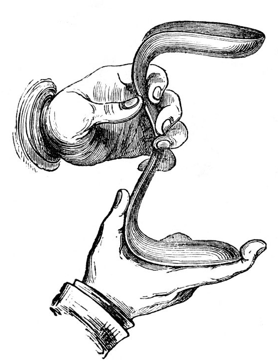  Dr. James Marion Sim's vaginal speculum