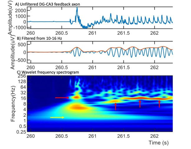 An image from the Scientific Reports paper by UC Irvine researchers shows sleep wave frequencies embedded in a slow wave in a single axon. The top row presents raw data from a feedback axon from the hippocampus’ cornu ammonis 3 region. The middle row shows the same data filtered from 10-16 Hz for spindle events. In the bottom row, spindle frequency hot spots appear in red, while the yellow arrow points to the slow wave near 1 Hz frequency. UCI